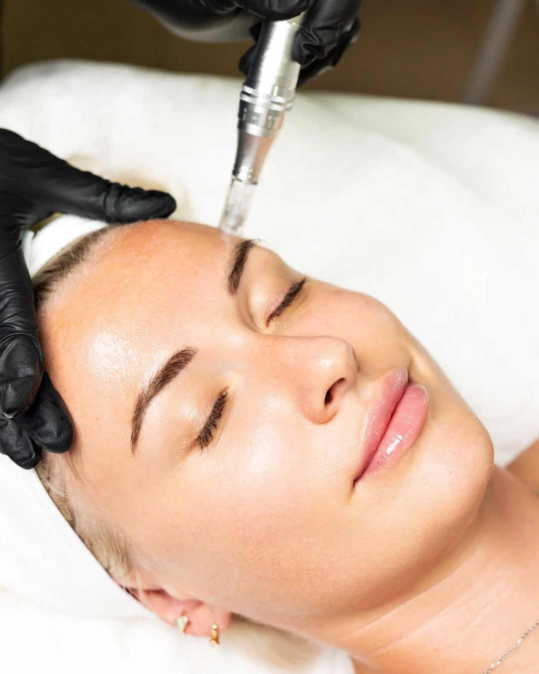 Advanced Skin Treatments treatment